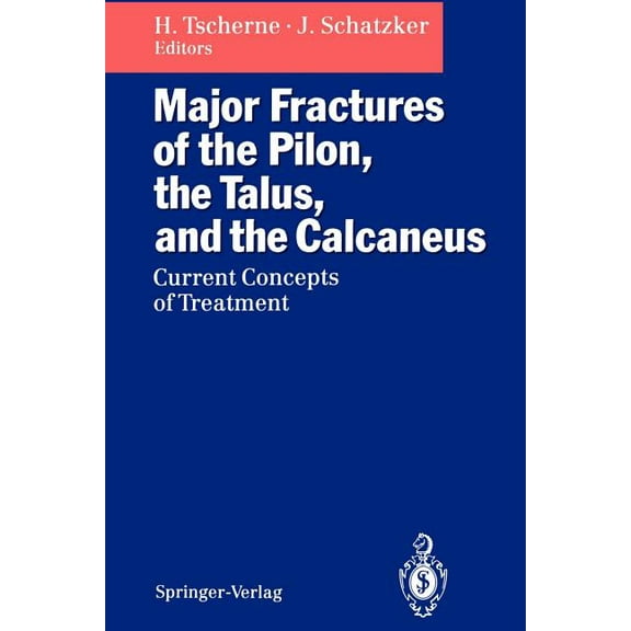 Major Fractures of the Pilon, the Talus, and the Calcaneus: Current Concepts of Treatment, (Paperback)