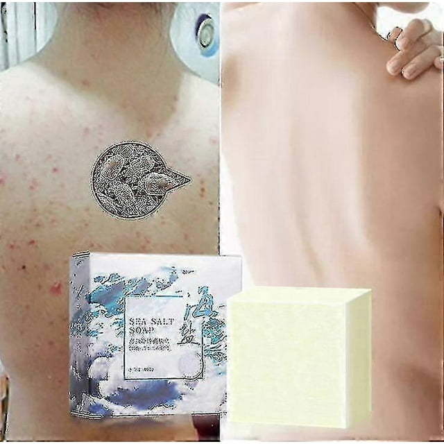 Anti Fungal Skin Soap Anti-mite Soap Handmade Soap Sea Salt Soap Antimite Oil-control And Firming Skin