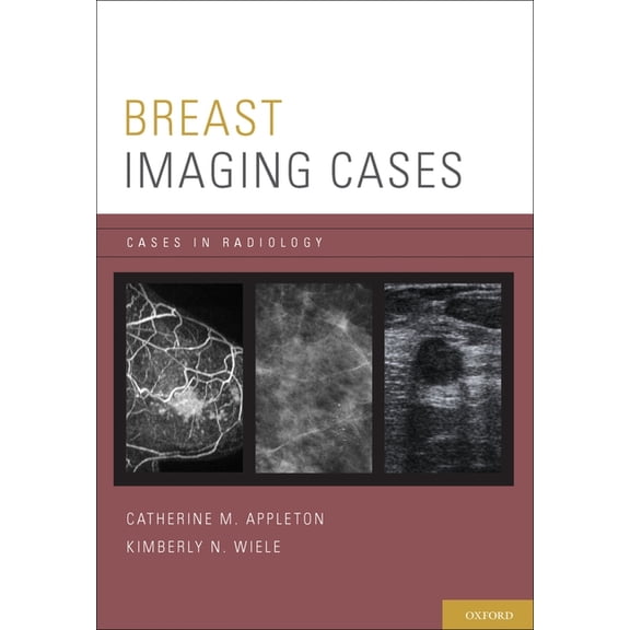Cases in Radiology Breast Imaging Cases Casrad P, (Paperback)