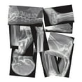 thumbnail image 3 of Roylco Broken Bones X-Rays – Human Skeletal Fracture X-Ray Set for STEM/STEAM Anatomy Lessons, Light Table Viewing & Hands-On Science Learning, 3 of 5