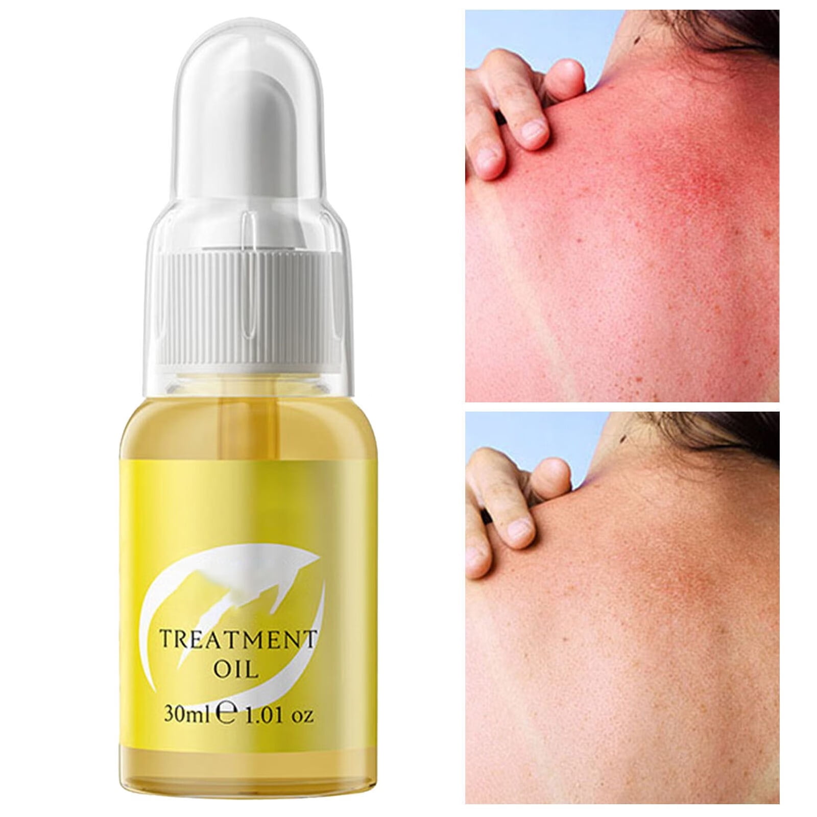 WTN Natural After Sun Lotion Made with Oils for Sunburn to Skin After