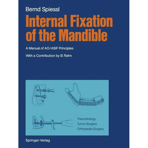 terrorism Nature Hamburger Internal Fixation of the Mandible : A Manual of Ao/Asif Principles (Paperback) - Walmart.com terrorism Nature Hamburger Internal Fixation of the Mandible : A Manual of Ao/Asif Principles (Paperback) - Walmart.com