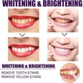 thumbnail image 4 of Hismile V34 Colour Corrector Teeth Whitening Gel Pen, Tooth Stain Removal 1-10pcs, 4 of 5