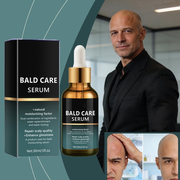 Pisexur Belleza Maquillaje Suero para el cuidado de la calvicie: hidratante con ácido hialurónico para el cuero cabelludo masculino, alivia la sequedad y protege (30 ml)para mujeres y hombres