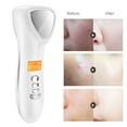 thumbnail image 3 of Skin Care Machine   Removal Device  Sonic Vibration Beauty Device  Face Beauty Tool Hot Cool Skin Care Machine  Removal Anti Aging Pore Minimizing Sonic Vibration Face Beauty, 3 of 8