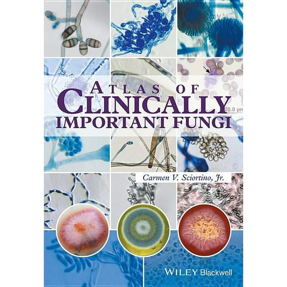 Atlas of Clinically Important Fungi (Hardcover)