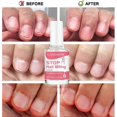 thumbnail image 3 of high qualityAnti Nail Biting Polish, Nail Bite Stopper, Nail Biting Prevention Polish, Discourages Nail Biting and Thumb Sucking For Kids Adults, 3 of 5