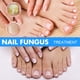 thumbnail image 4 of Nail fungo treatment - soluciones antifúngicas y tratamientos de hongos de uñas bajo las uñas - reparación de dedos y uñas CAIXIN Solución reparadora para uñas, 4 of 6