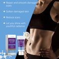 thumbnail image 2 of Hoygi Skin Repair Cream Skin Repair Mark Care Moisturizes Delicate Skin Daily Body Care, 2 of 5