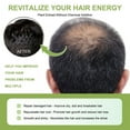 thumbnail image 5 of 5PCS Hair Growth Rosemary Spray,Plant Organic Rosemary Essential Oil, Hair Hair Strengthening Oil Effective Nourishing Rosemary Split End Care Hair Growth Oil for Daily Use, 5 of 10