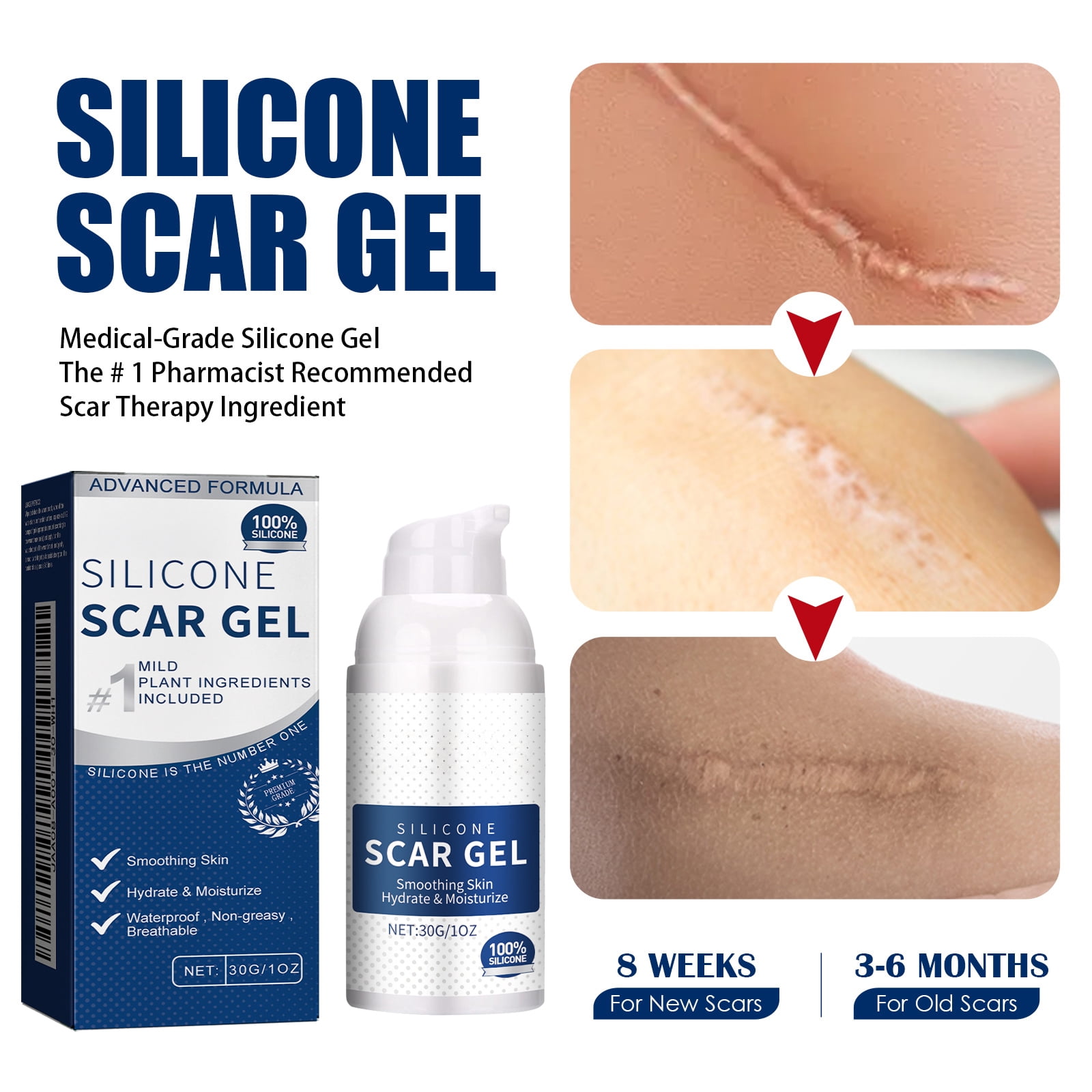Alvantor Silicone Scar Gel for C-Section, Stretch Marks, Acne, and Surgery Scars