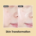 thumbnail image 2 of Ampolla Medi-Peel Pure Gold 24K Antienvejecimiento Antiarrugas 100 ml, 2 of 5