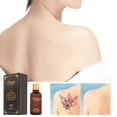 thumbnail image 1 of Fiudx Eliminator Tatuajes, Tatuajes Tatuajes, Tatuajes de Fórmula Suave, Decolorante Sin Cicatrices, Limpiador Hidratante para Cejas, Apto para Todo Tipo de Piel, Solución de Eliminación Rápida, Idea, 1 of 6