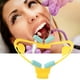 thumbnail image 1 of Abridor de boca oral Intraoral Mejilla Labio Retractor Expansor dental (S Amarillo) Ndcxsfigh Nuevos Originales, 1 of 9