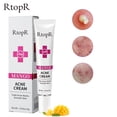 thumbnail image 3 of RtopR-crema Facial antiacné con Mango, Gel eliminador de granos, remedio para encoge los poros, pomada nutritiva para el tratamiento del acné, cuidado Facial, 3 of 5
