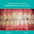 Opalescence Go™ Prefilled Teeth Whitening Trays 15 Hydrogen