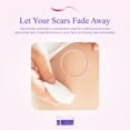 thumbnail image 5 of Derminish Scar Wipes - Acne & Scar Remover, Stretch Mark Pads - 50 Pads, 5 of 11