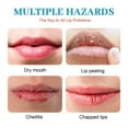 Angular Cheilitis: 5 Stages You Need To Know (With Pictures!) - 4i68a0p