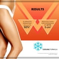 thumbnail image 2 of Sérum corporal, loción reafirmante y crema anticelulítica Eveline Slim Extreme 4D Liposuction, 2 of 7