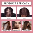 thumbnail image 5 of Sérum para el crecimiento del cabello 50 ml con fórmula no grasa de rápida absorción para cabello fino y quebradizo., 5 of 5