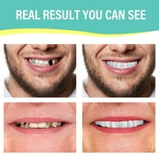 Fake Teeth, Denture Teeth, Confidence Smile Temporary Teeth