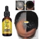 thumbnail image 1 of Ginger Hair Growth Fluid-, 1 of 3