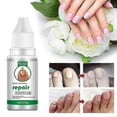 thumbnail image 4 of Nail Fungus Treat Onycho, 4 of 5