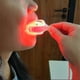thumbnail image 1 of 2024 Dispositivo terapéutico de luz roja LED para terapia de gingivitis y alivio de cura de llagas dentales, 1 of 5