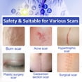 thumbnail image 6 of Medical Grade Silicone Scar Tape - Clear Scar Removal Sheets for Old & New Scars, Burns & Scalds, Surgical Scar, Cut-to-Size 1.6" X 120" Roll, 6 of 10