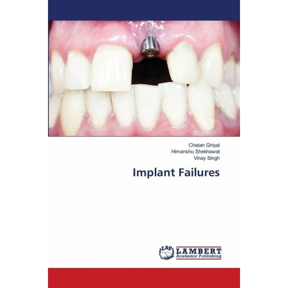 Implant Failures, (Paperback)