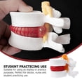 thumbnail image 2 of MasteelfCA 1pc Human Spine Model Lumbar Disc Herniation Presentation Model for School, 2 of 7
