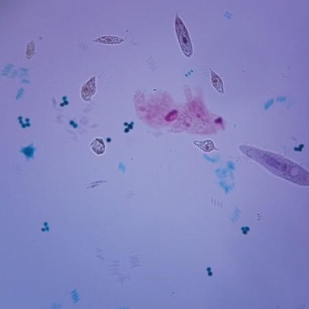 Mixed Protists  W.M. Microscope Slide price history on PriceWatchPro