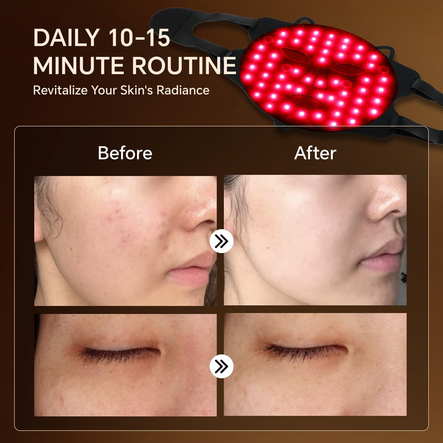 Stylish Cat-Ear LED Facial Light Mask, Soft Silicone Beauty Device with Red & Infrared Light to Complement Your Skincare Regimen, Cordless & Travel-Friendly