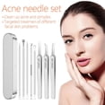 thumbnail image 2 of Professional Pimple Extractor Kit, Ultra-Sharp Stainless Steel Blackhead & Comedone Remover Tweezers, Acne Clip Beauty Tool with Storage Case, 2 of 8
