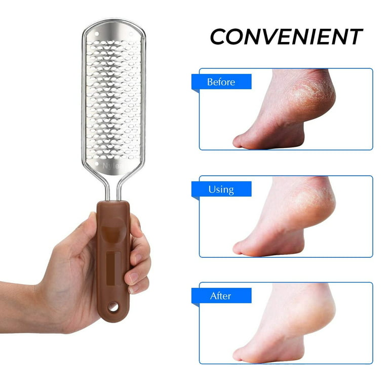  MEGAFILE Foot File Callus Remover for Feet (XL Size) NYK1 Foot  Scrubber Feet Scrubber Dead Skin Remover for Feet Foot Scraper Hard Skin  Foot Callus Remover - Foot Pumice Stone