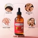 thumbnail image 5 of Aceite de semilla de rosa mosqueta Yoken, 120 ml, 100% puro para rostro, piel y cicatrices, 5 of 7