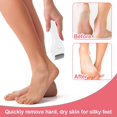 thumbnail image 2 of Electric Feet Callus Removers Rechargeable Foot File Pedicure Tools with 2 Grinding Heads Professional Foot Scrubber Electronic Callus Remover Kit for Remove Feet Hard and Dead Skin, 2 of 9