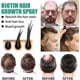 thumbnail image 4 of Biotin Hair Growth Spray Serum Anti Hair Loss Treatment Hair Regrowth for Women Men, 4 of 5
