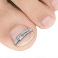 thumbnail image 1 of Nail Clip For Ingrown Toenails Silver, 1 of 5