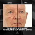 thumbnail image 2 of Tratamiento de estiramiento facial y sérum para ojos Beverly Hills para hombres, 2 of 8