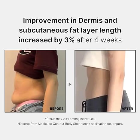 Medicube Age-R Contour Body Shot - Slimming & Tightening Device