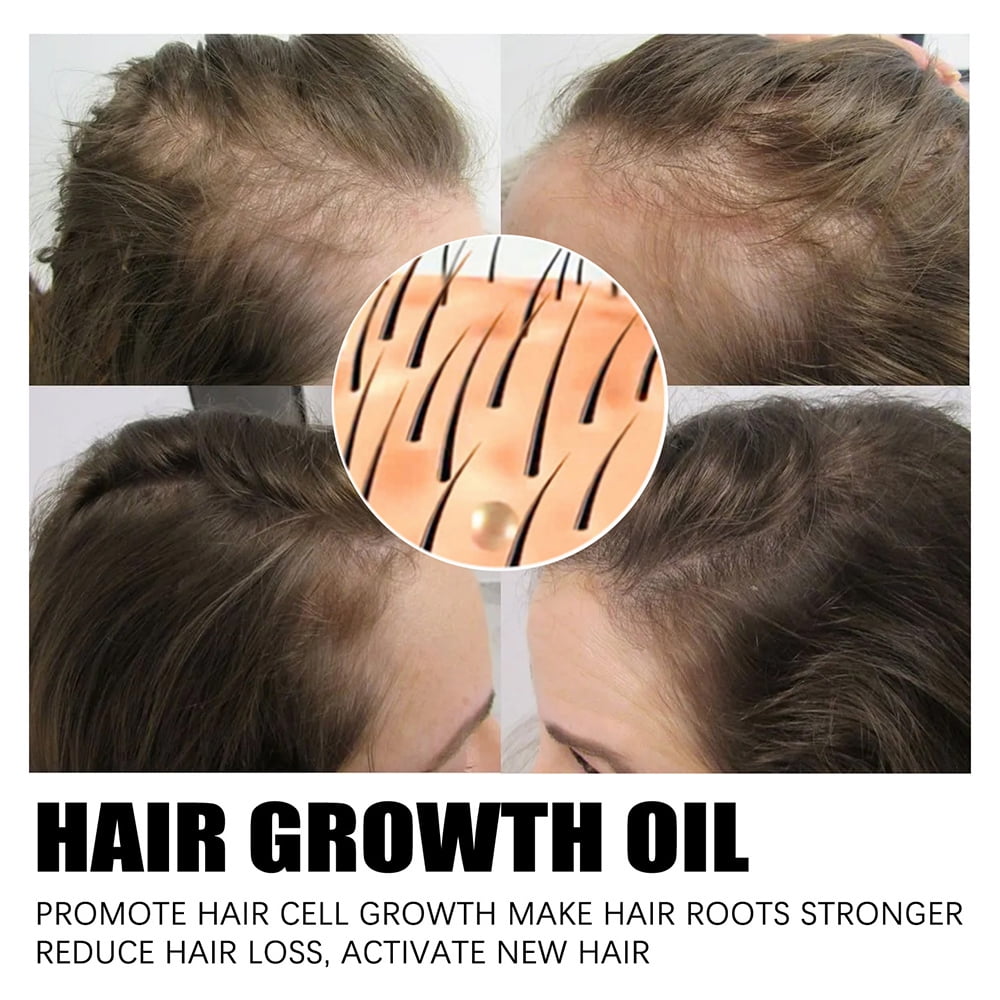 West&Month Hair Growth Essential Oil 30Ml Hair Conditioning Serum Hair Oil  Repair Damaged Hair Anti-Hair Loss Anti-Frizz 