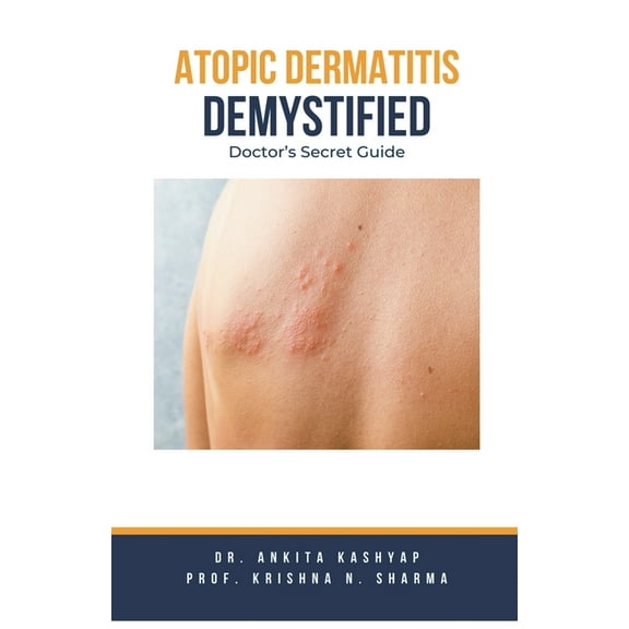 Atopic Dermatitis Demystified: Doctor's Secret Guide, (Paperback)