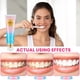 thumbnail image 5 of Pasta de dientes Loojzz Niacinamide Blanqueadora con Encías Nutritivas, 5 of 7