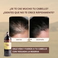 thumbnail image 4 of Shampoo de Caballo NEGRO para Uso Humano, Yeguada la Reserva - Ideal para Todo Tipo de Cabello | Estimula el Crecimiento, Fortalecimiento y Brillo | 1 L (3 Botellas), 4 of 8