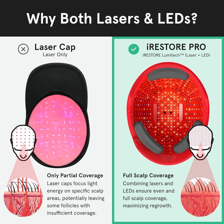 iRestore Professional 282 Laser Cap for Hair Regrowth | FDA