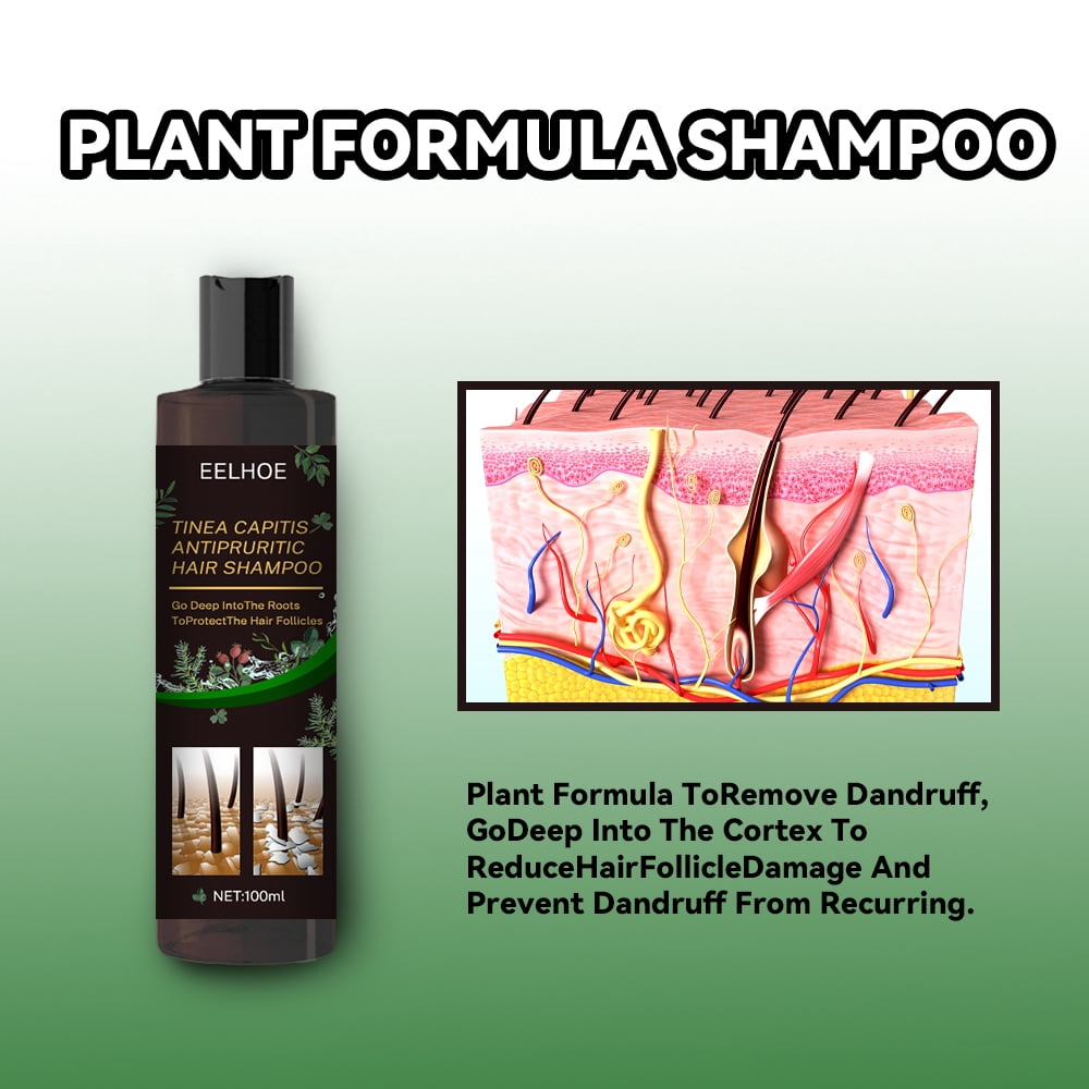 Ringshlar Hair Shampoo for Tinea Capitis Antipuritic Professional Antidandruff Remove Mites and Relieve Itching Shampoo 10.14 Oz