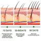 thumbnail image 3 of Rose Mary Oil For Hair Growth Skin Care, Nourishment Scalp, Stimulates Hair Growth, Improves Blood Circulation 30ml -, 3 of 5
