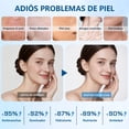thumbnail image 3 of WEUD Skin Care Coreano 4 En 1 Kit, con 1 Crema Hidratante Niacinamida + 1 Crema para Cuello + 1 Serum Centella Asiatica + 1 Serum P&eacute;ptidos Prop&oacute;leo, Hidrata, Ilumina, Reduce L&am, 3 of 7