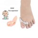 thumbnail image 1 of 2-Pack Kids Bunion & Overlap Toe Corrector, Hallux Valgus Splint Protector, White, 1 of 4